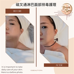 人手facial - 磁叉瘦面療程